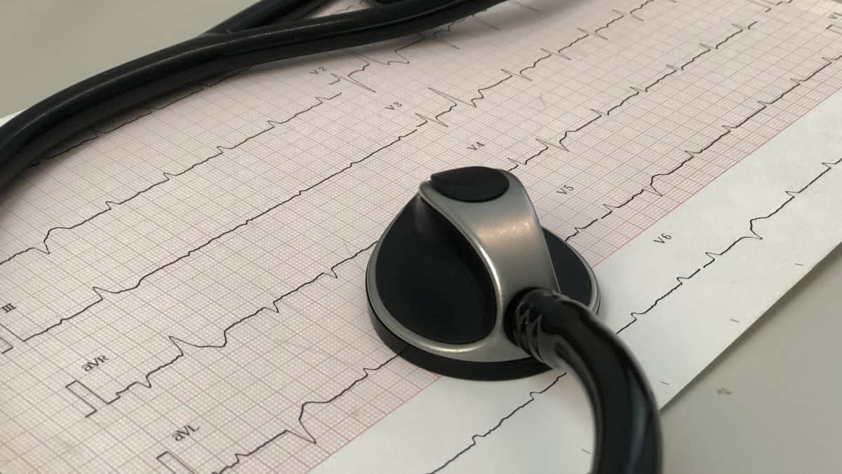 EKG metodą Holtera – na czym polega i co wykrywa?