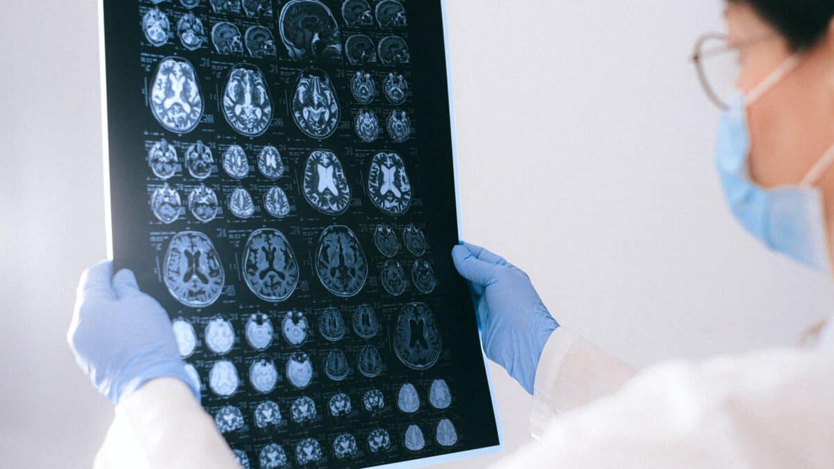 Wstrząs mózgu – czym jest, jak się objawia i jakie niesie ze sobą zagrożenia?